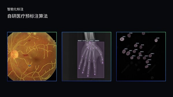 澳鵬MediGo平臺集成醫(yī)療專用NER模型、問答對自動生成系統(tǒng)和自研預標注算法